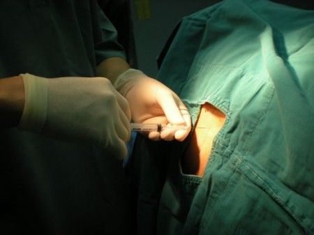 Sydney:un trapianto di midollo guarisce due pazienti dall’HIV e dal cancro