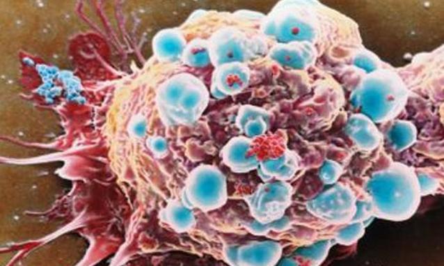 Cancro: trovata la molecola che ubriaca  e sconfigge le cellule tumorali