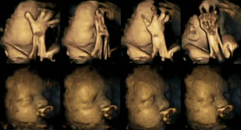 Le immagini shock di un bambino nel ventre di sua madre fuma