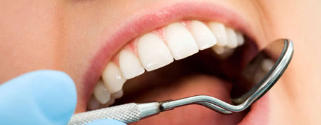 Scarsa igiene dentale potrebbe aumentare il rischio di ictus